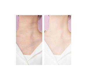 Masajeador Reductivo SkinCare Cuello Rostro Ultrasónico Rosado