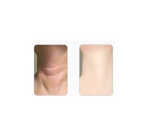 Masajeador Cuello Facial Papada Maquina Restauradora